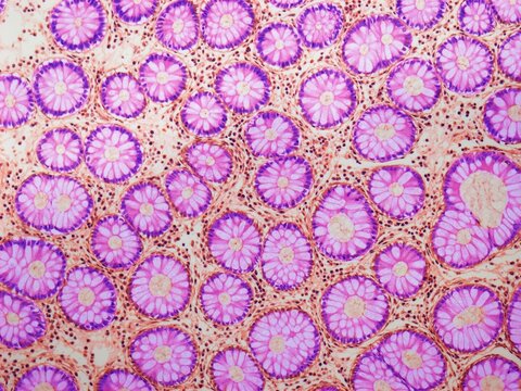 Crypts of Lieberkuhn, LM