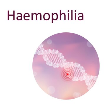 Haemophilia, illustration