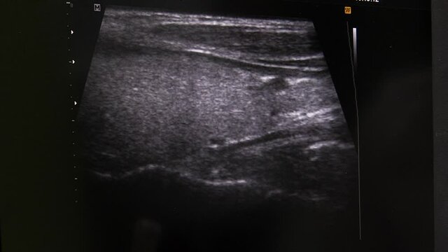 Ultrasonography doctor using researcher scanner on patient