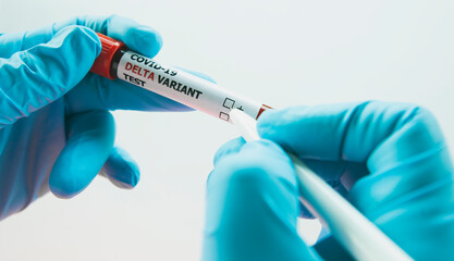 laboratory assistant marks a positive blood test by red check mark