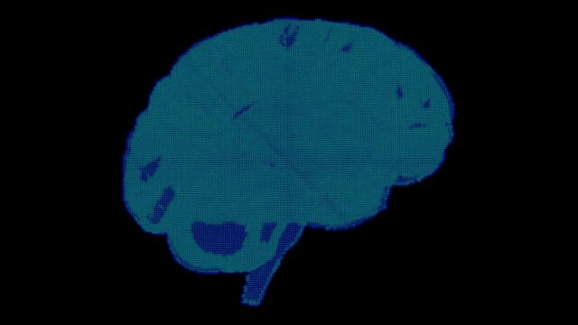 3D turntable x-ray on brain on black background , Computerized Tomography scan concept.