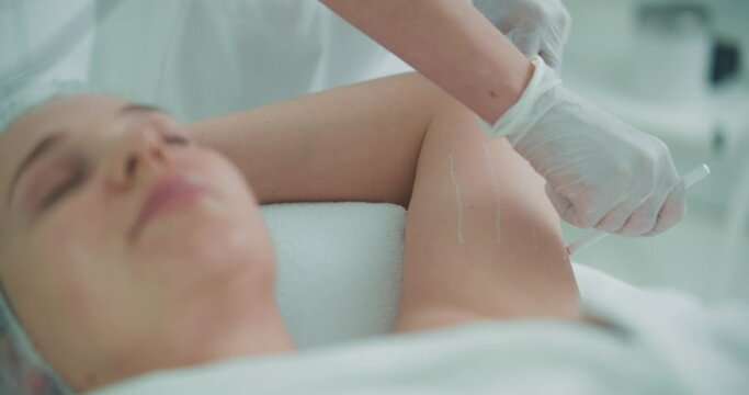 A female client is laying with closed eyes in the cosmetology bed while a cosmetologist is using a cosmetic pencil for painting white lines on the arm.