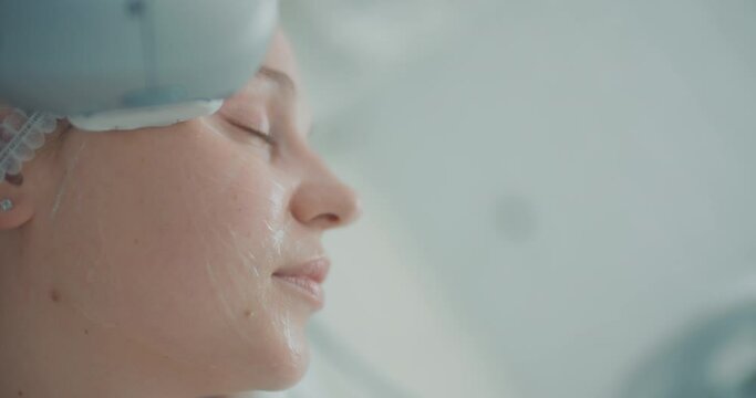 A close-up female client with cream on her face is having a face lifting procedure by using the Ultraformer apparatus.