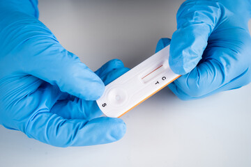 Lab performing rapid diagnostic test for antibodies to detect presence of antigens COVID-19 disease.