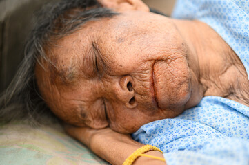 The wrinkled face of an old Asian woman sleeps alone at home alone