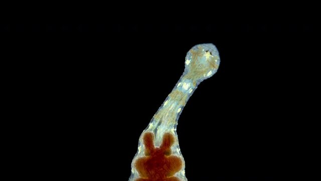 Leech of the family Glossiphoniidae under a microscope, order Rhynchobdellida. Possibly the genus Hemiclepsis. Freshwater, sucks blood from fish, amphibians