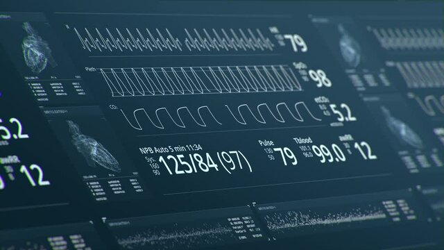 MRI scanning. Dynamic Heart beat line, pulsating heart. Cardiogram signal monitoring process. Patient&rsquo;s vital signs displayed on hospital screen. EKG, ECG curve. Pulse measuring. Medical 4K animation
