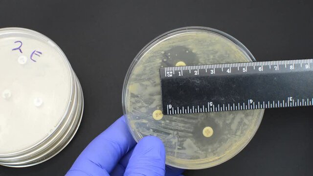 performing antimicrobial resistance test interpretation by measuring with ruler