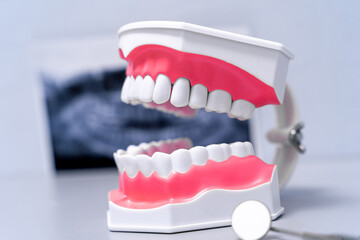 Educational model of jaw section with teeth on world map background. Dentistry concept. Stock photo