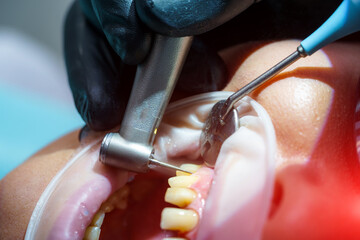 Patient woman at the dentist's appointment. The dentist injects the medicine into the hard gum tissue, providing a quick effect of anesthesia