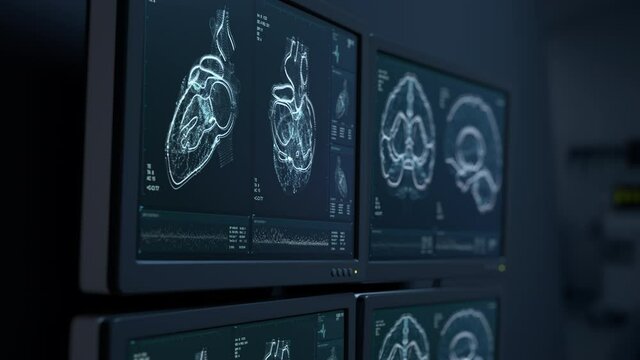 MRI heart and head scanning. Brain tumor, cancer X-ray diagnostics. Patient’s vital signs displayed on hospital screens. Disease diagnosis. CT scan Human ilness research 3D Render Medical 4K animation