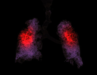 CT Chest 3d rendering showing lung infection from covid-19.