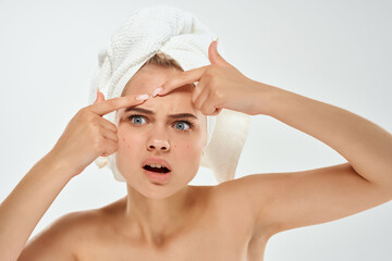 pretty woman with a towel on her head squeezes out pimples on her face skin care problems