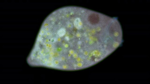 Stentor Ciliophora Infusoria under microscope, order Heterotrichida, feed on small organic residues, bacteria, algae, protozoa. Longitudinal rows of short cilia are visible