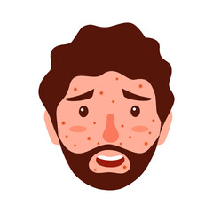 Man with itching face in flat design on white background. Allergy skin. Acne facial skin problem.