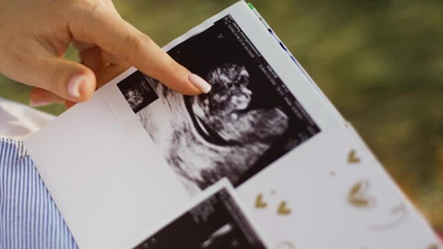 A woman expecting a newborn has an album with ultrasound images of the unborn baby and strokes them with her finger with tenderness and awe. A pregnant woman is preparing to become a mother for child