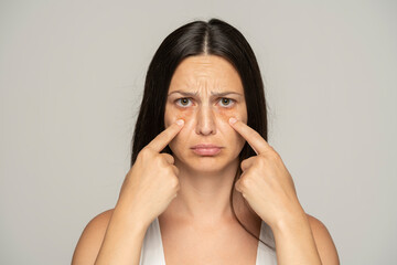 a young unhappy woman touches her undereyes