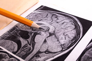 MRI image of the brain on paper