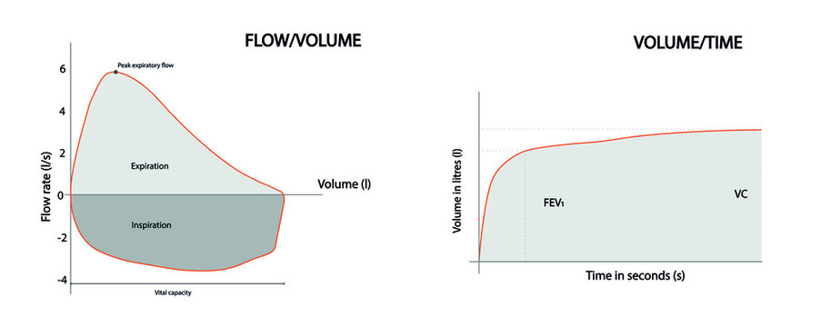 Normal Spirometry curves. Graph of volume  time and of peak expiratory flow volume loop when breathing in and out. Spirometry test.