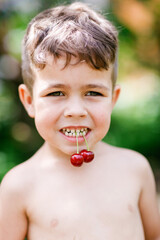 Little boy holds cherries in his teeth - 452648004