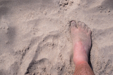 First-person view of the gritty feet of a man walking along the beach. The shot was taken in good lighting conditions.