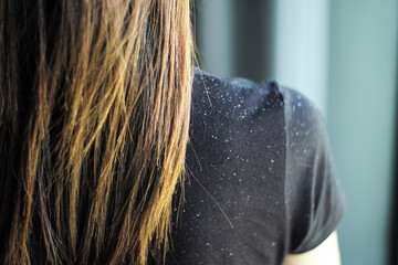 Rear view of woman having the dandruff on the shoulder