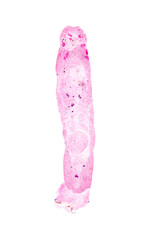 The study parasite or worms is a freshwater fish parasite in laboratory for education.
