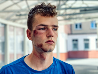 Young guy, teenager with wounds and abrasions on his face