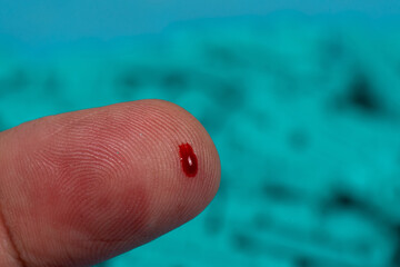 fingertip with blood, ready to take blood glucose test