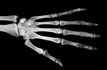 human palm bones on black background