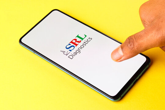Assam, india - April 10, 2021 : SRL Diagnostics logo on phone screen stock image.