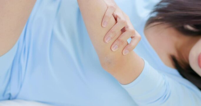 woman scratching her elbow