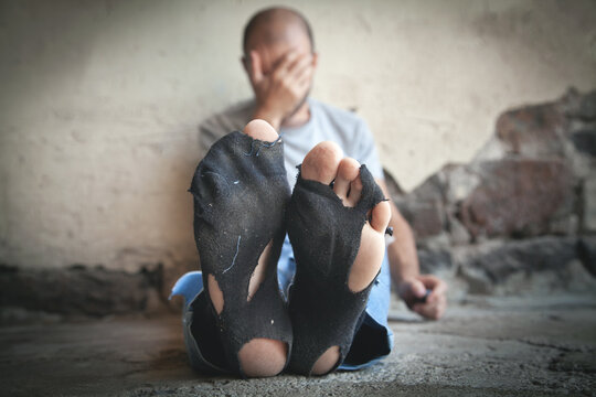 Poor feets of a caucasian homeless man.