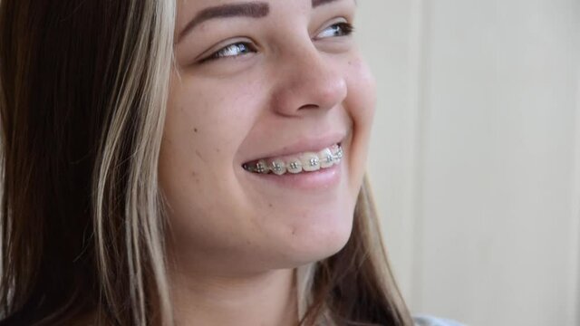 Beautiful caucasian young girl with green eyes looks at camera and sincerely laughs. Brunette teen girl in dental braces nickers. Teenage concept. Tooth alignment with braces. Cheerful young woman.
