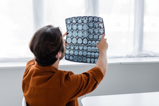 Man Looking At Mri Scan At Home Against Window