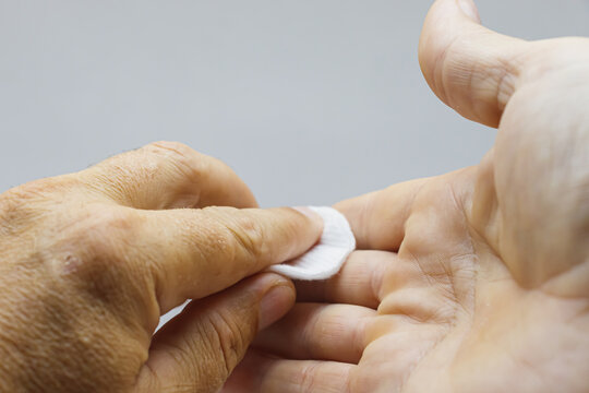 The man disinfects his hands with a cotton pad with disinfectant. Hands with a white cotton pad close-up on a light background.
