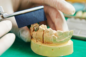 Dentist hand working with tooth prosthesis