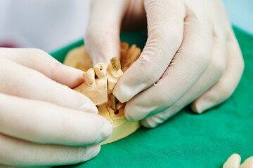Obraz na płótnie Canvas Dentist hand working with tooth prosthesis