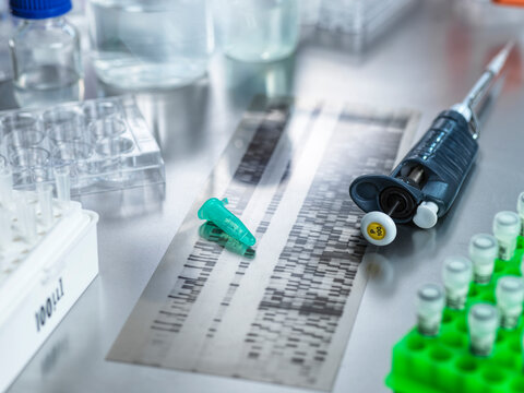DNA gel sample in laboratory