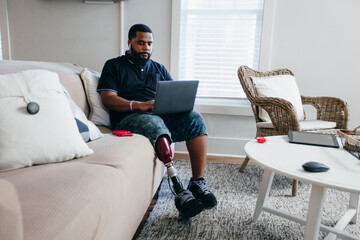 Black man with prosthetic leg working from home on laptop