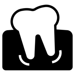 wisdom tooth