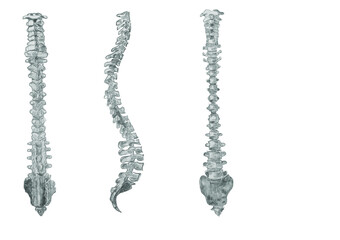 x image of spine