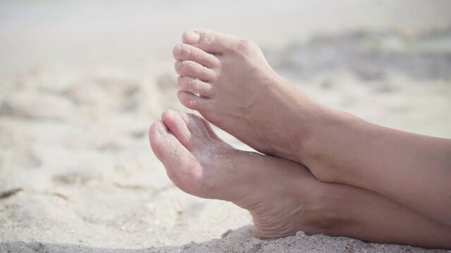 Hallux valgus on female legs close up beach sand. Foot joint deformity. Health care and medicine problem with human body. Vacation Traveling Halluxvalgus