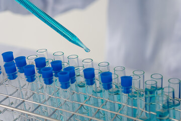 The pipette lowers the sample into the test tube. Close-up scientists are experimenting and...