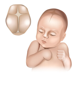 An illustration of a realistic babys head showing the fontanelles present at birth. Cranial sutures and fontanels. Baby s Soft Spots.