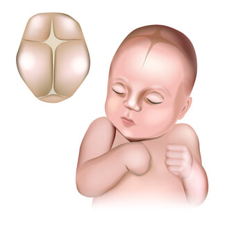 An illustration of a realistic babys head showing the fontanelles present at birth. Cranial sutures and fontanels. Baby s Soft Spots.