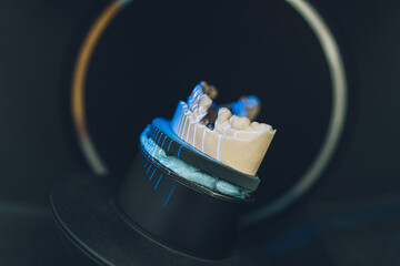 Inside a scanner with a dental mould being scanned with laser rays in a laboratory - obrazy, fototapety, plakaty
