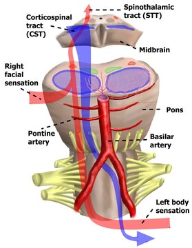 The illustration shown the pathways of spinothalamic tract and corticospinal tract.