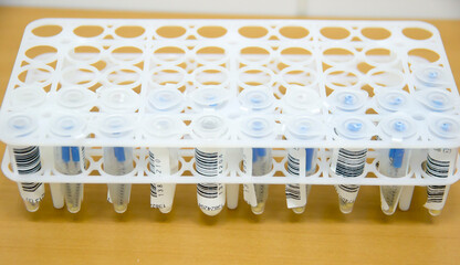 Eppendorf tubes with  Coronavirus (COVID 19)  biomaterial with barcodes in white test tube rack on a desk in laboratory