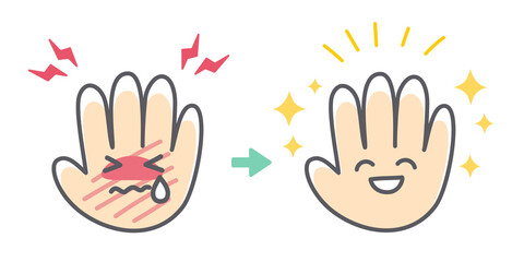 Fototapeta premium 手荒れのトラブルが回復するビフォーアフター